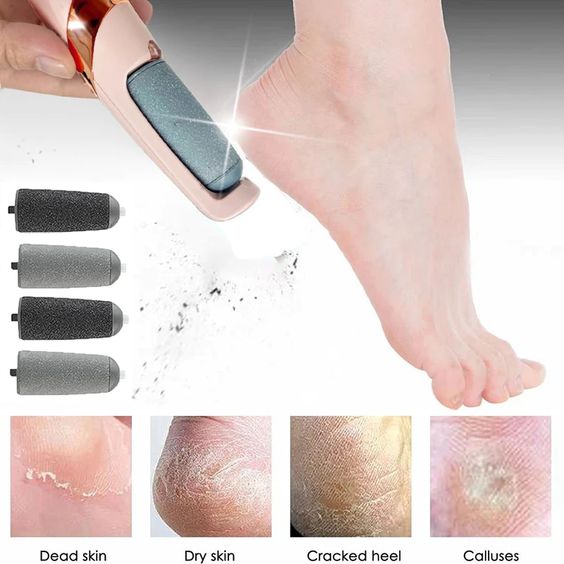Footcleaner™ Nettoyeur de callosités électrique, de la peau dure et morte des talons et ongles à 2 Rouleaux
